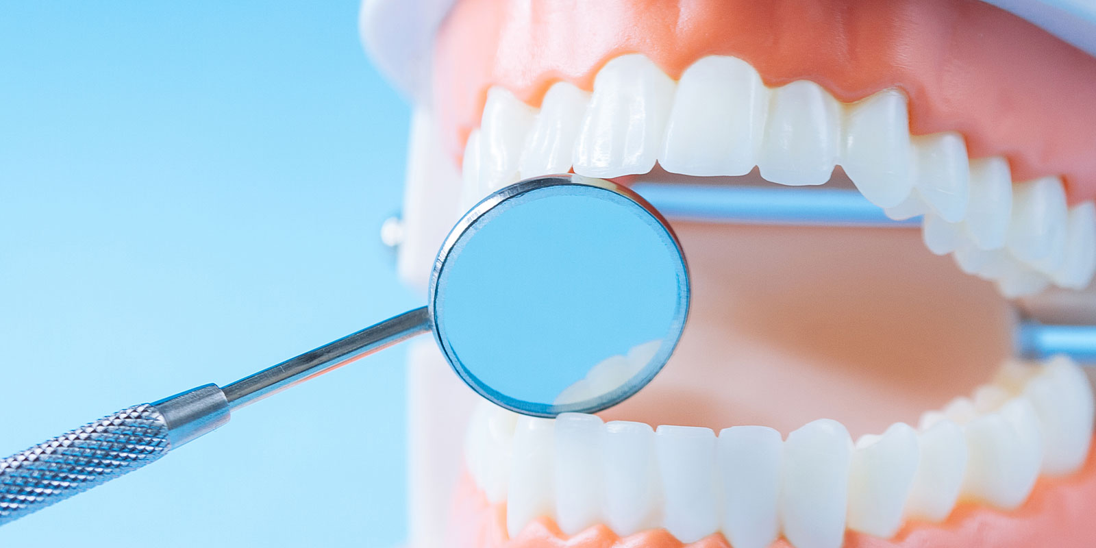 予防歯科・定期検診