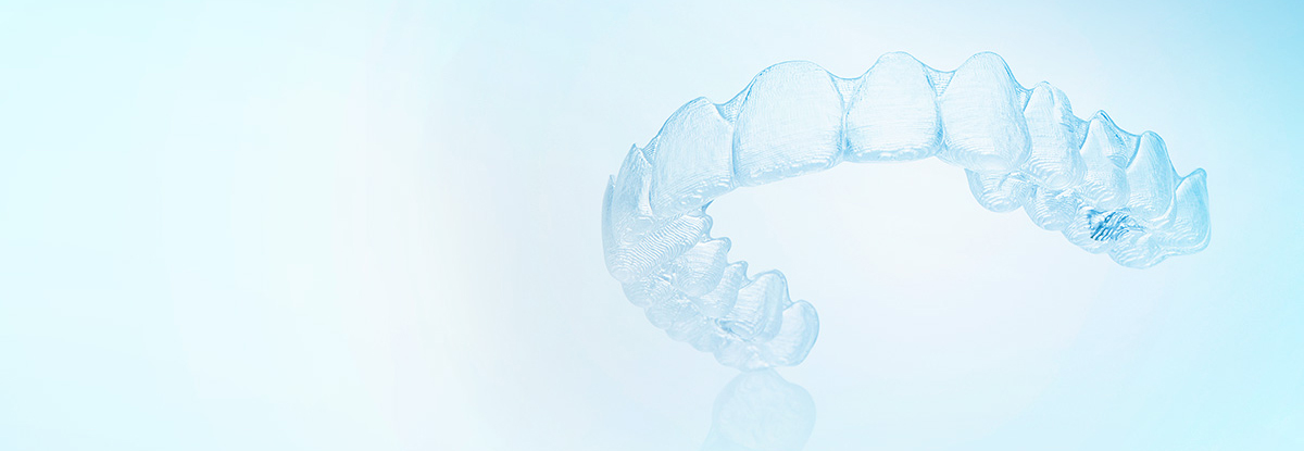 インビザラインの費用を抑えるための工夫