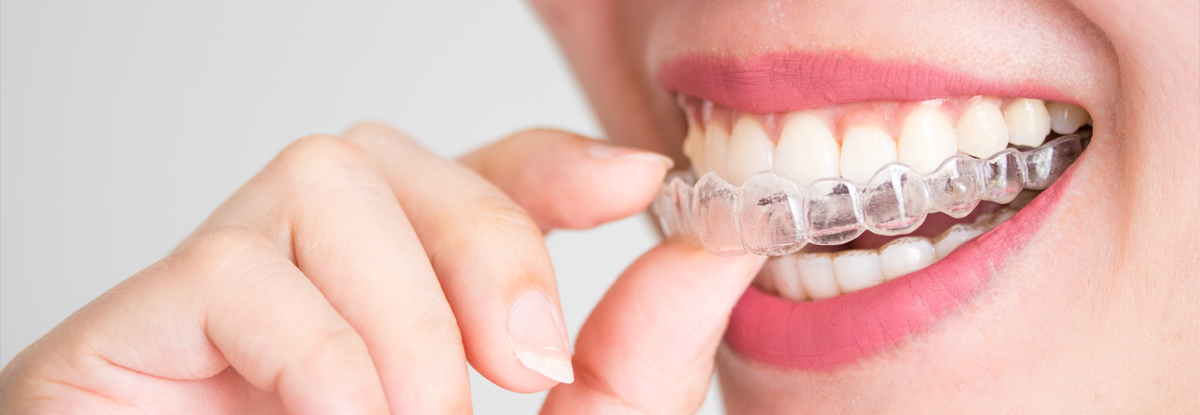 アタッチメントが取れた・外れたときの対処法