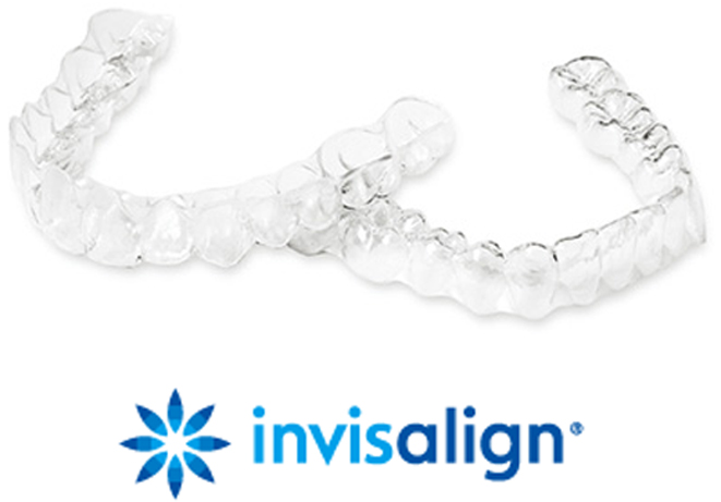 インビザラインのアタッチメント